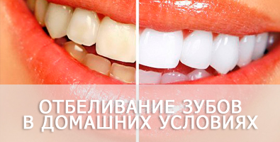 Методы отбеливания зубов в домашних условиях